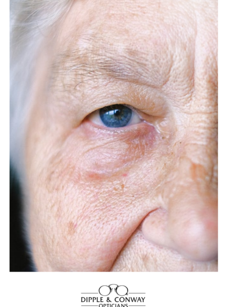 Elderly blue eye